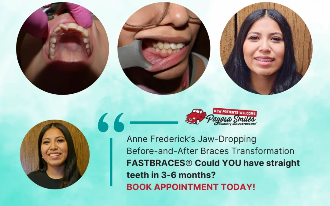 FastBraces Pagosa Springs: Real Before & After Braces in Just 3-6 Months